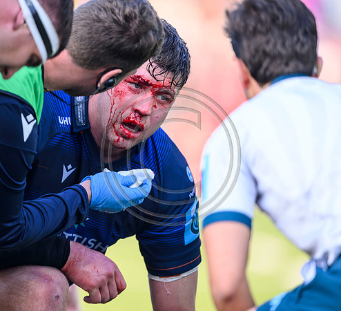 Edinburgh v Munster